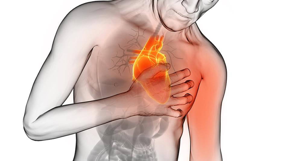 Molecole in grado di prevedere l’infarto: la scoperta di uno scienziato calabrese