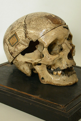 Il cranio del brigante Villella esposto al Museo Lombroso di Torino
