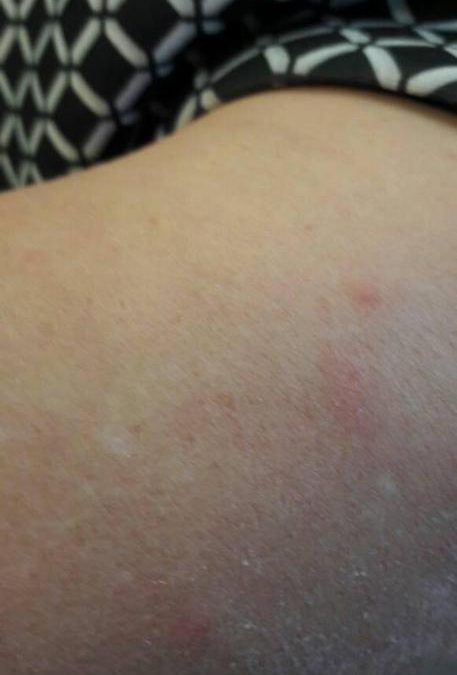 Invasione di zanzare in ospedale, scatta la denuncia