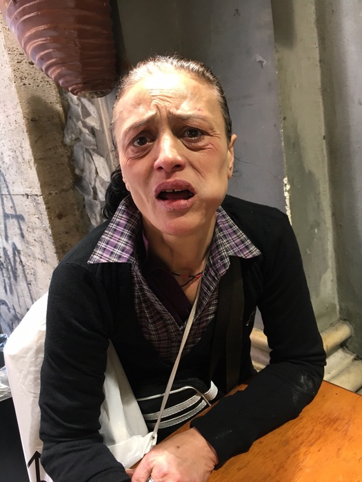 Napoli, donna senzatetto vittima di baby gang: aiutatemi