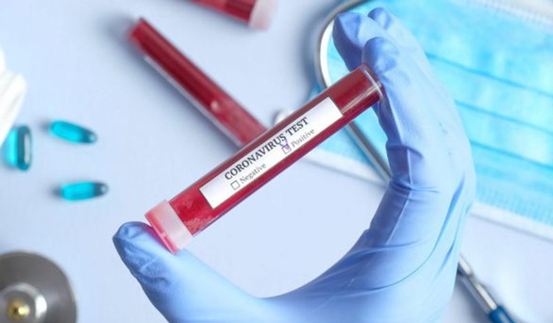 Coronavirus: in Campania rilevati 66 nuovi casi