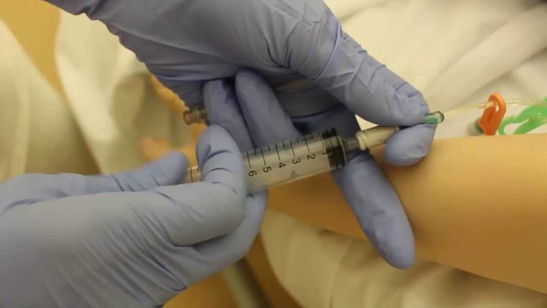 Lotta al coronavirus, a Cosenza 8 pazienti sperimentano il farmaco contro l'artrite