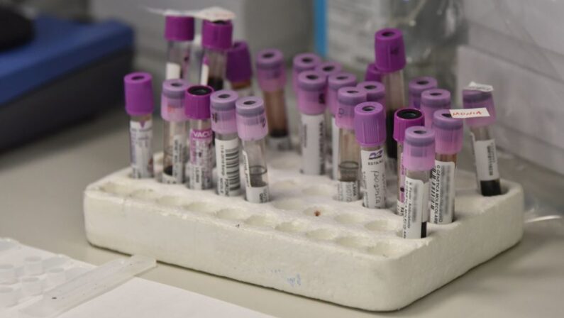 Coronavirus in Calabria: Anche oggi zero contagi, nell'ultimo mese registrati solo 11 casi