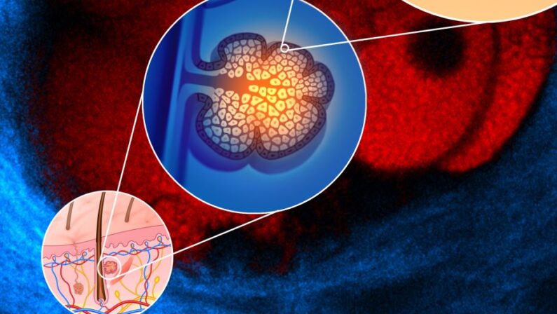 Salute, un anticorpo monoclonale per contrastare sindrome di Clouston
