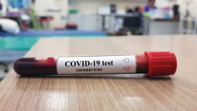 Coronavirus in Calabria: un contagio nelle ultime 24 ore e nessun guarito portano i casi attivi a 98