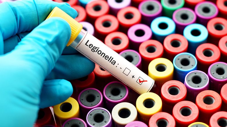 Accertati 16 casi di legionella a Busto Arsizio, un morto