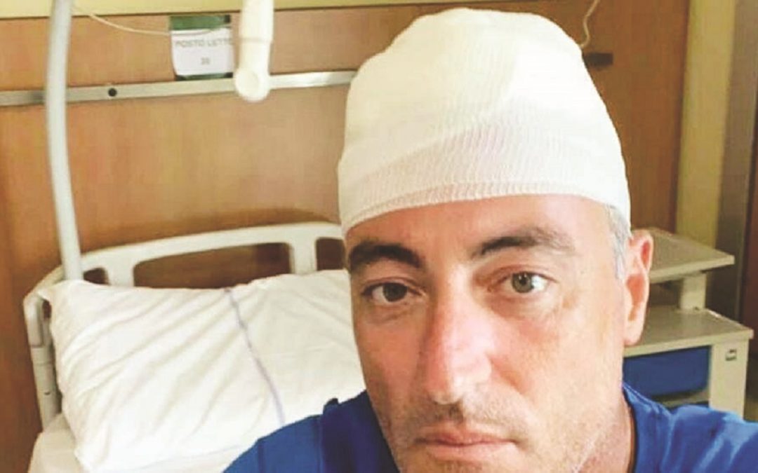 L’assessore lombardo alla Sanità Giulio Gallera dopo l’incidente avuto durante le vacanze estive