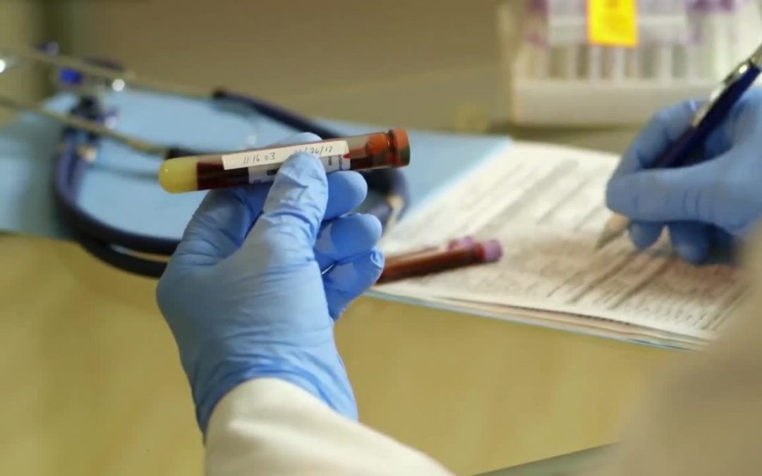 Emofilia A, nuovo trattamento con meno somministrazioni