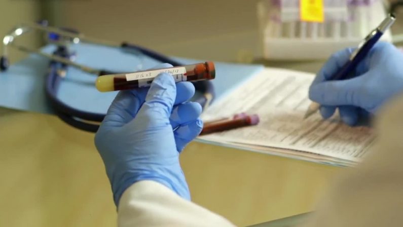 Emofilia A, nuovo trattamento con meno somministrazioni