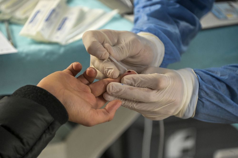 Covid, 20.648 nuovi casi e 541 vittime nelle ultime 24 ore