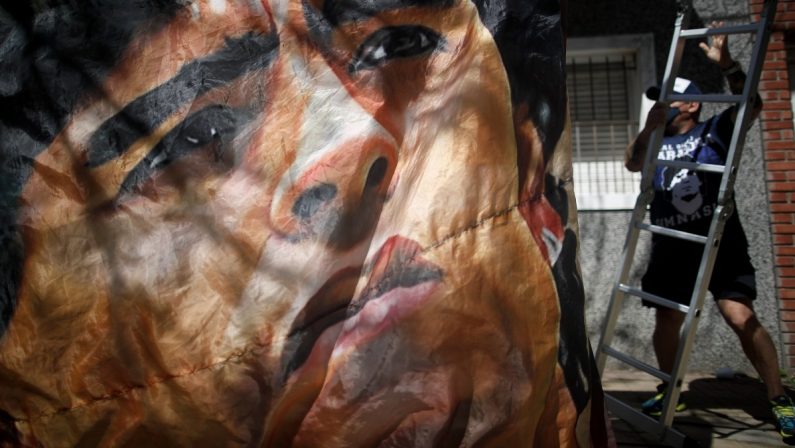 Diego Armando Maradona sarà operato al cervello