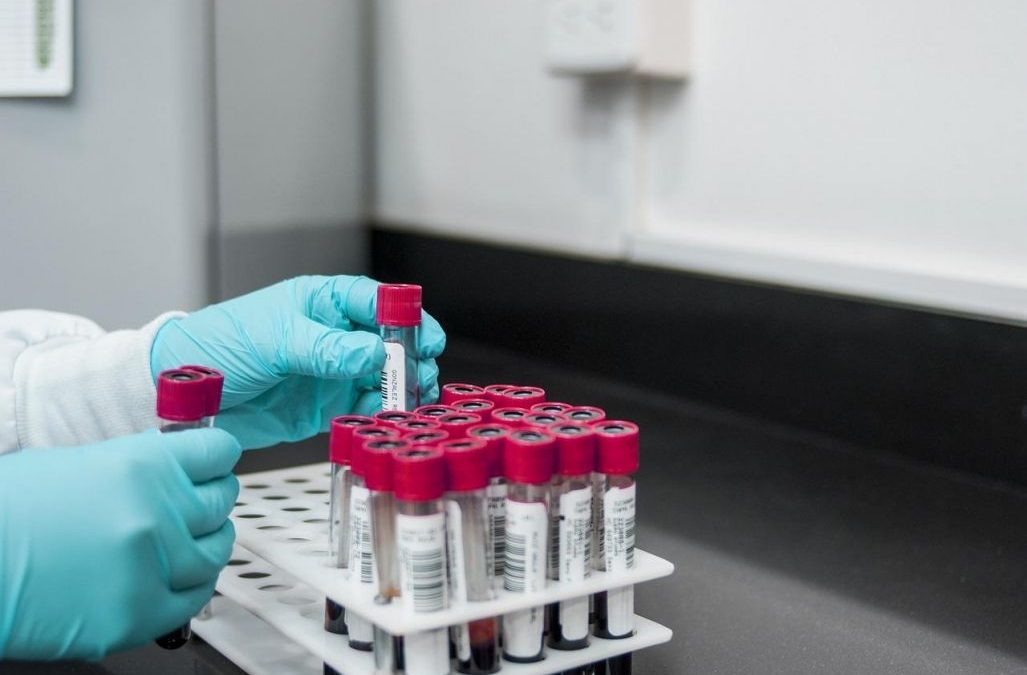 Trapianti, staffetta di 20 donatori con sangue raro per salvare donna