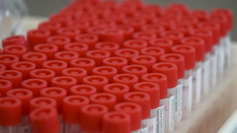 Tumori, è made in Italy la terapia intelligente