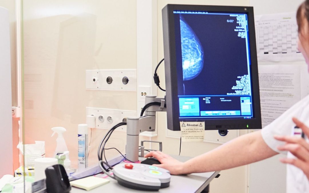 Carcinoma mammario. Menarini e Radius Health, risultati positivi Emerald
