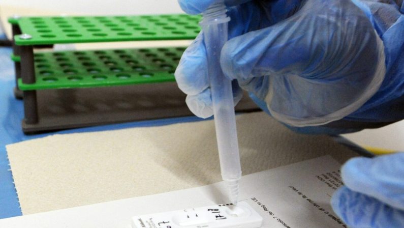 Covid, 75.862 nuovi casi e 325 decessi in 24 ore