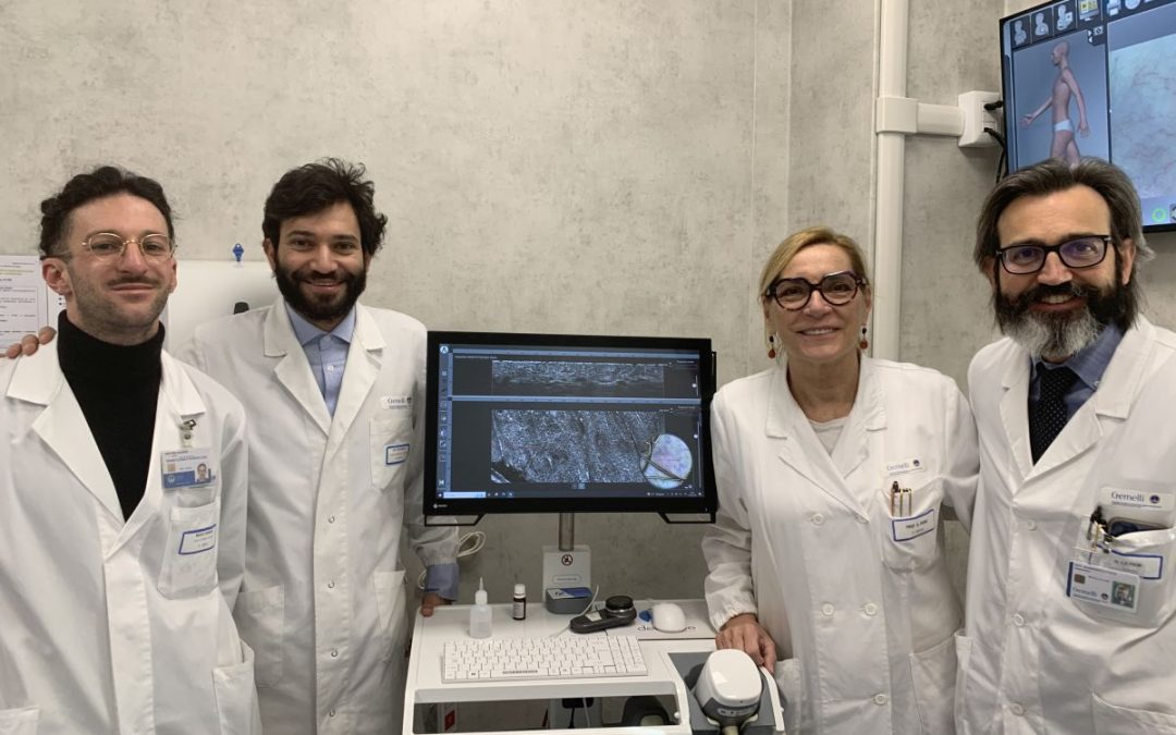 Tumori della pelle, al Gemelli biopsia virtuale per la diagnosi precoce