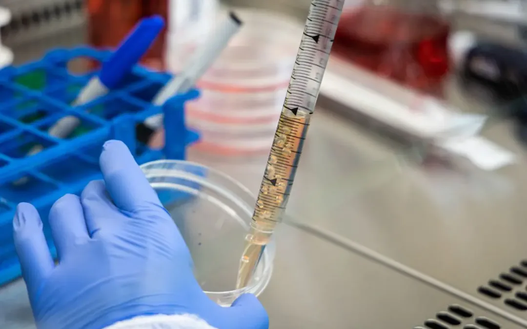 Sanofi, nuovo anticorpo riduce la progressione della sclerosi multipla