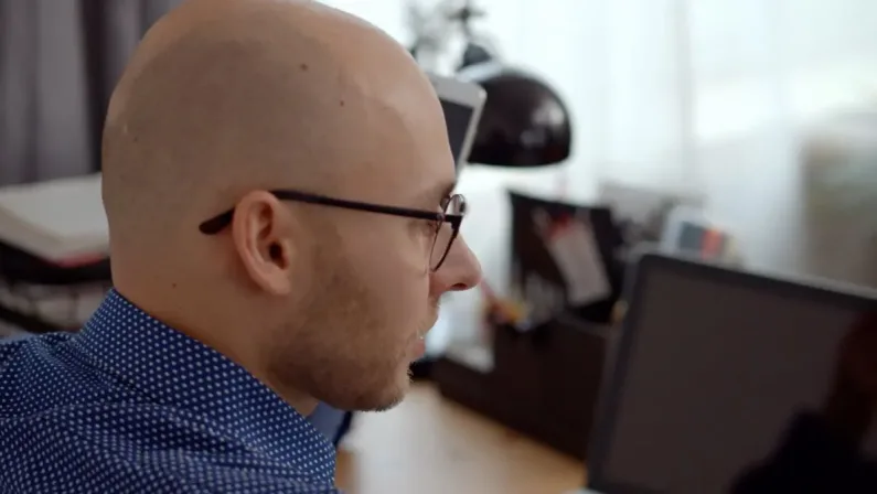 Alopecia, in Italia colpisce 4 uomini su 10. Il trapianto una soluzione