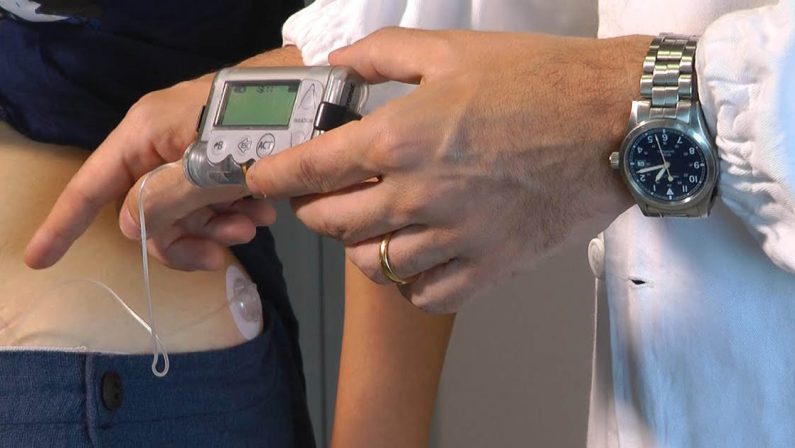 Odissea diabetici a Reggio: l'appello di una madre a Occhiuto... e arrivano i microinfusori