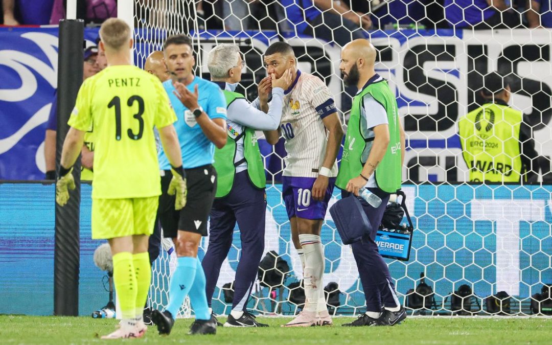 Francia, Mbappè salterà il match contro l’Olanda