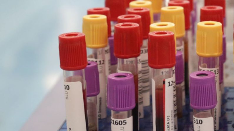 Botulino, dal 2001 al 2024 segnalati 1.276 casi in Italia