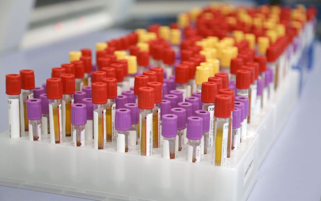 Botulino, Meo (Artemisia Lab) “Attenzione alle conserve fatte in casa”