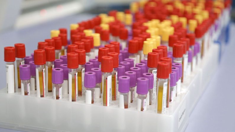 Botulino, Meo (Artemisia Lab) “Attenzione alle conserve fatte in casa”
