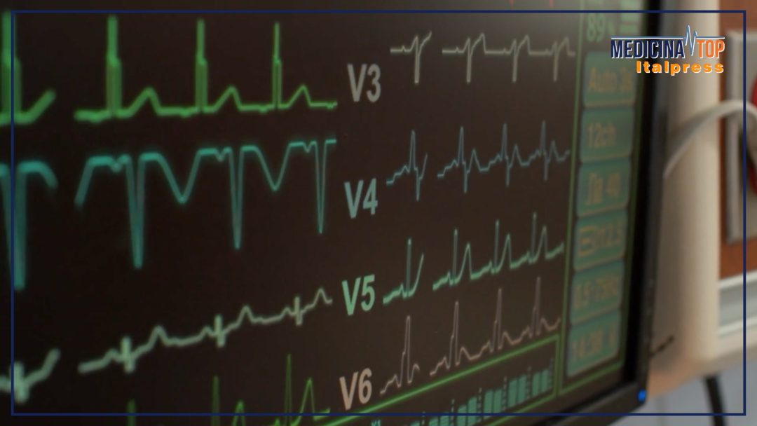In Italia 100 mila casi di ictus ogni anno, prevenzione e cure fanno la differenza