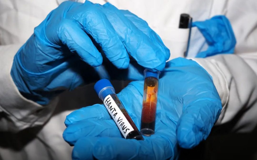 Hantavirus, test negativo su turista inglese al Sacco di Milano