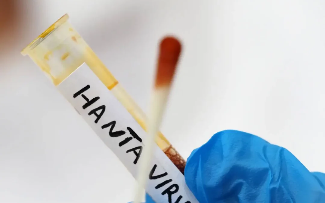 Hantavirus, nessun caso in Italia, negativi i test anche sul giovane calabrese