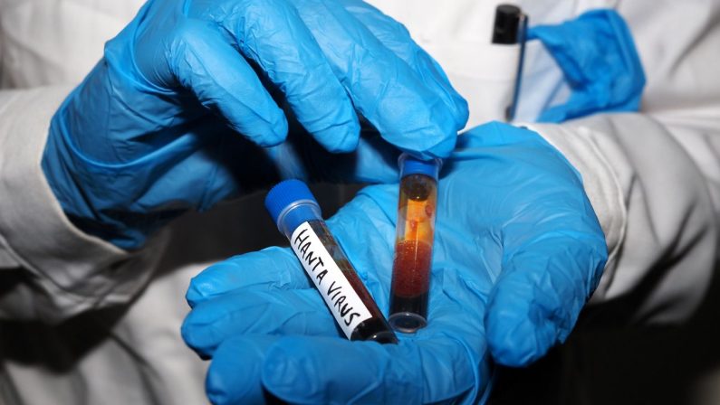Hantavirus, test negativo su una turista inglese al Sacco di Milano