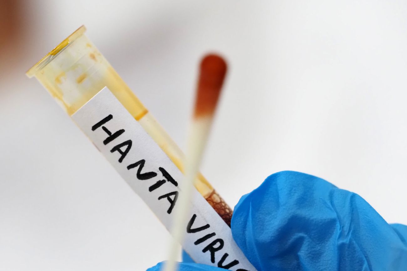 https://www.quotidianodelsud.it/wp-content/uploads/2026/06/hantavirus-1-1.jpg