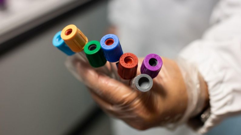 Pubblicato un studio preclinico sull’Indolo-3-Carbinolo contro l’infezione da SARS-CoV-2
