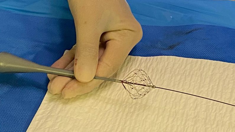 Fibrillazione atriale, Aou Marche: “Prima volta in Italia ablazione con catetere a campo pulsato”