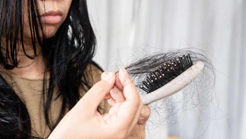 Con nuovi farmaci anti diabete e obesità più rischi di perdere i capelli, lo studio