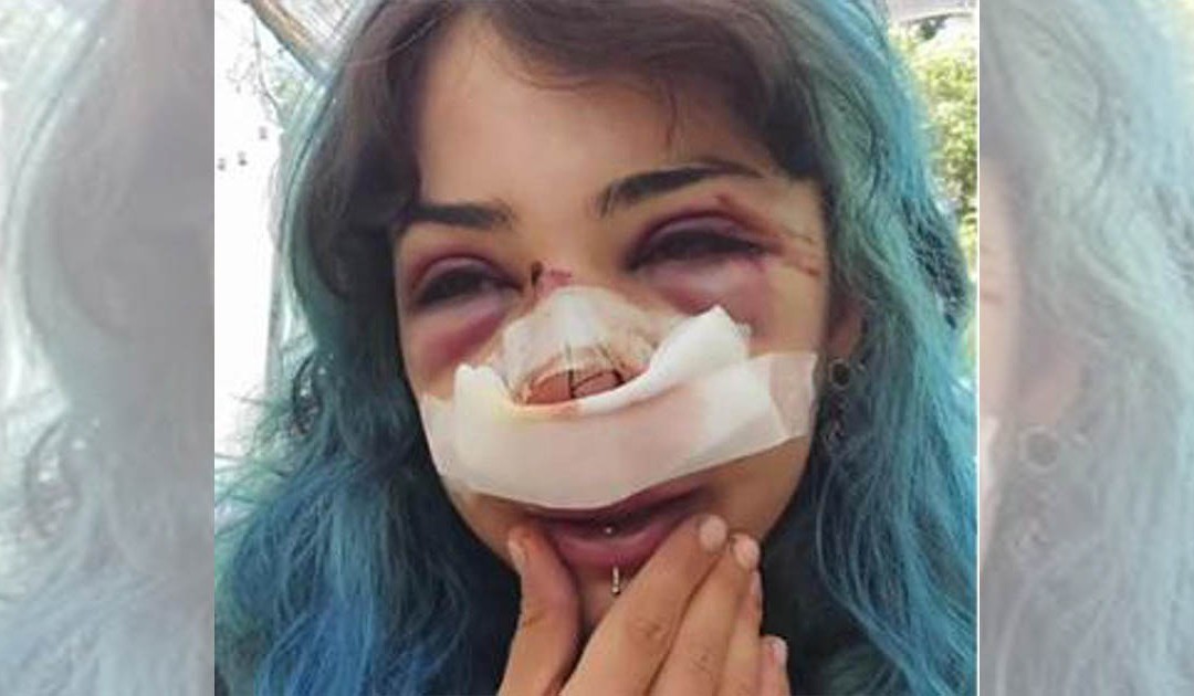 Bari, studentessa picchiata nei bagni denuncia nuovo episodio: «Mi hanno accerchiata»