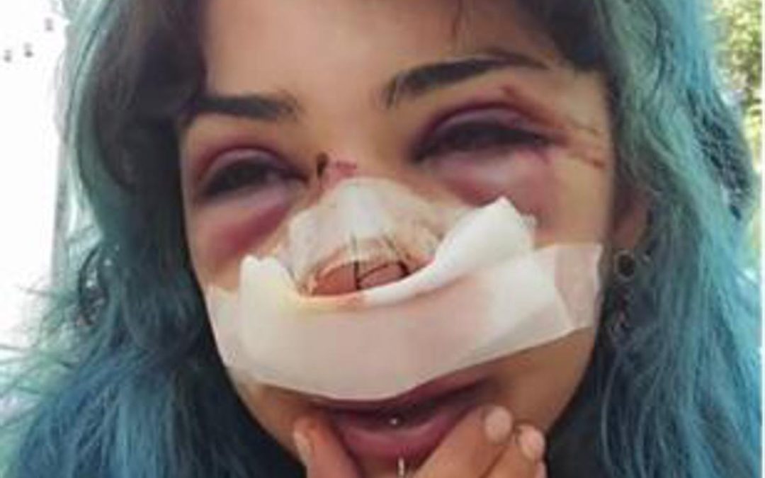 Bari, studentessa picchiata al parco: indagati per lesioni e rapina custode bagni e il compagno