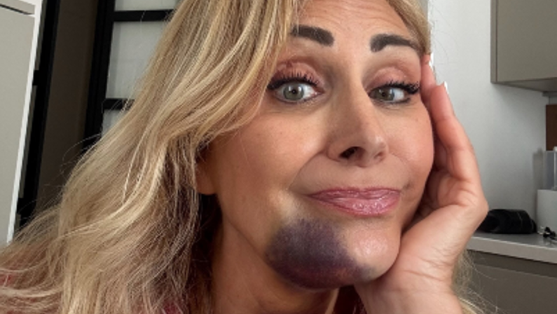 Marina Di Guardo, l’incidente in Sicilia con un trattore: il racconto sui social