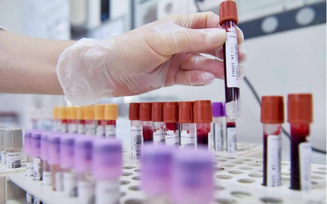 Dal microbiota una speranza contro l’epilessia resistente, lo studio italiano