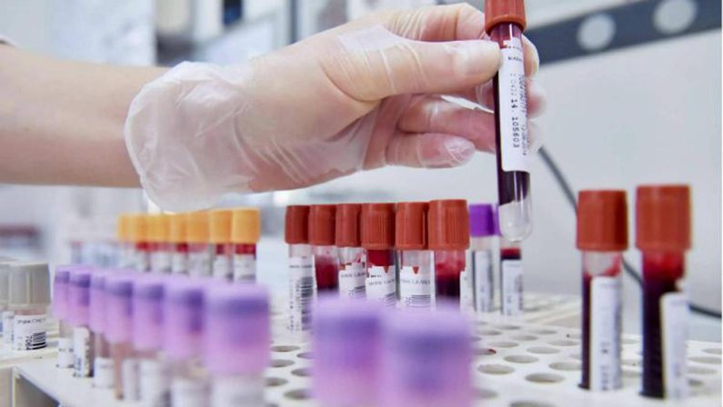 Dal microbiota una speranza contro l’epilessia resistente, lo studio italiano