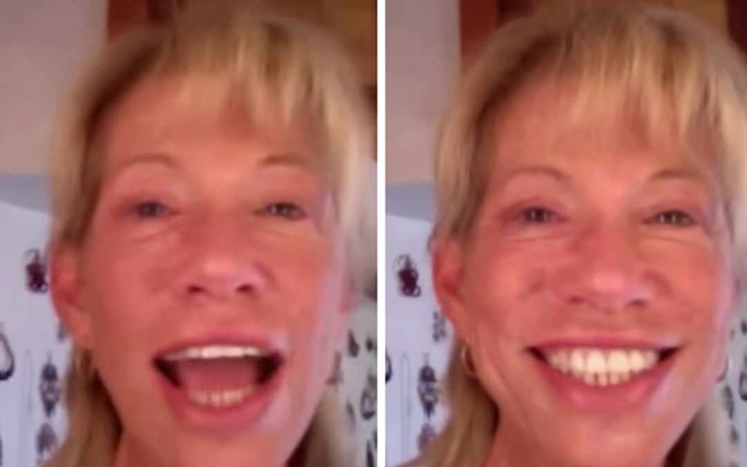 Carly Simon rivela la diagnosi di Parkinson: “Continuo a vivere, scrivere e cantare”