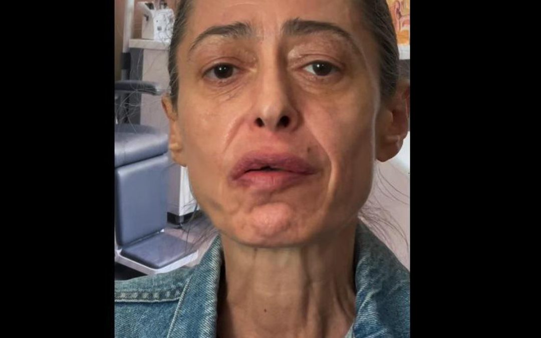 Gerardina Trovato annulla il tour: “Devo operarmi d’urgenza”