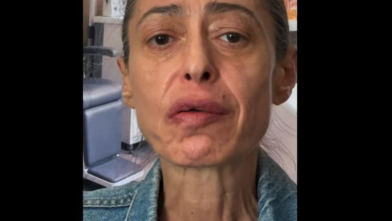 Gerardina Trovato annulla il tour: “Devo operarmi d’urgenza”