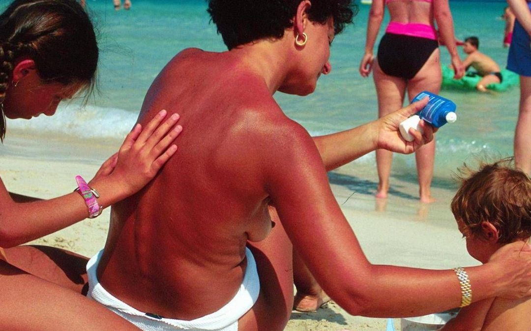 Creme solari fatte in casa, il monito degli esperti: “Pericoloso trend guidato dalle fake news”