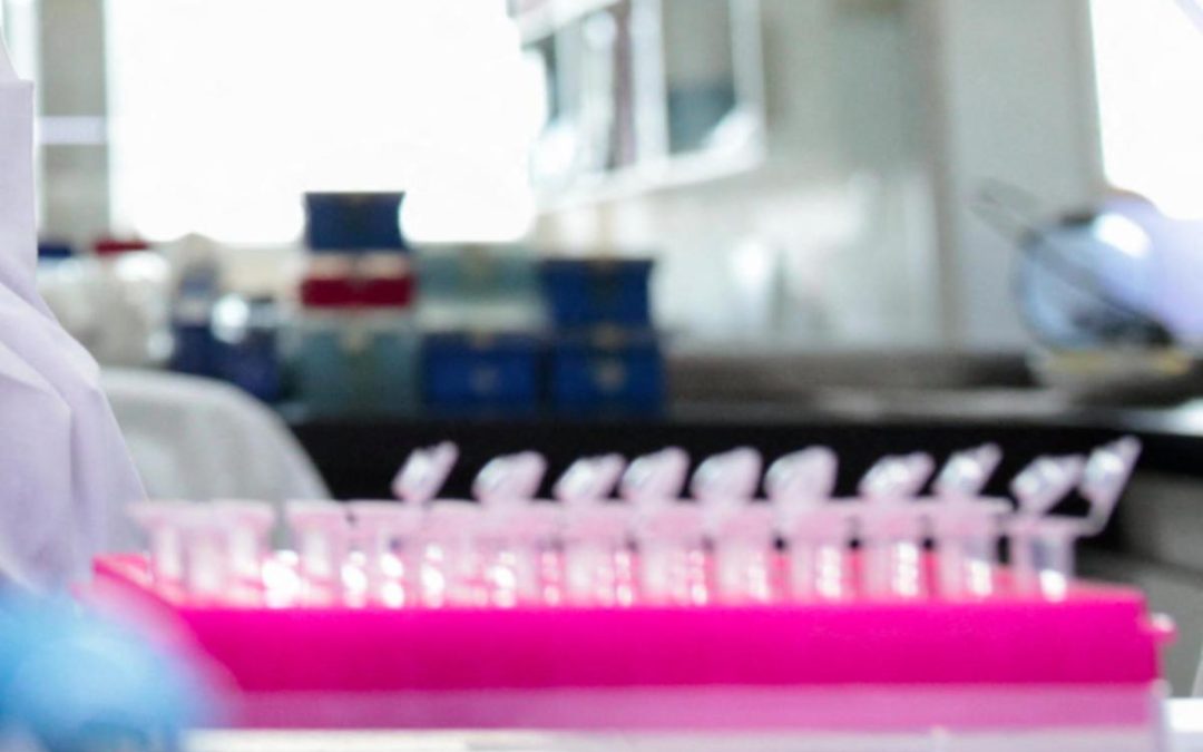 Milano, focolaio di tubercolosi all’Istituto di Medicina legale: 8 casi conclamati e 7 positivi. Indagini sull’origine del contagio