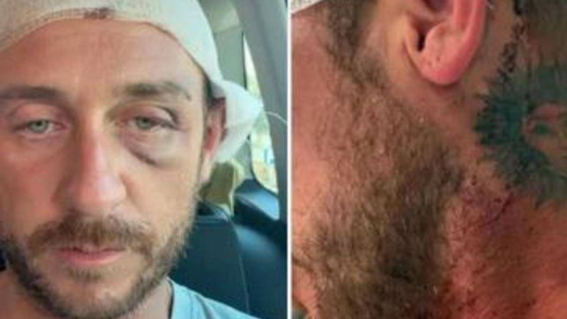 “Io aggredito a sassate in Sardegna da 30 persone perché gay”, la denuncia sui social ﻿