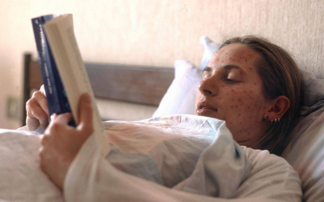 Morbillo in Italia, il Ministero: “Possibile criticità in copertura vaccinale, c’è rischio di aumento della circolazione”