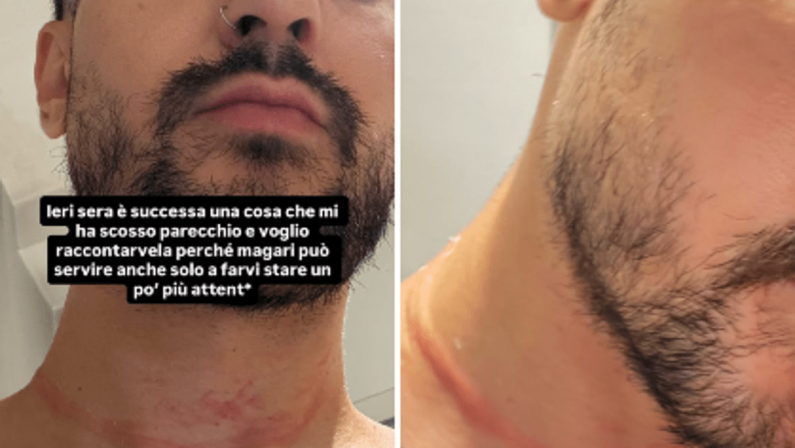 Mr. Daniel, il make-up artist dei vip, aggredito e rapinato a Milano: il racconto choc sui social