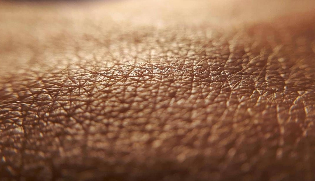 Dermatite atopica, quando la pelle condiziona la vita, ‘Diari atipici’ dà voce ai pazienti
