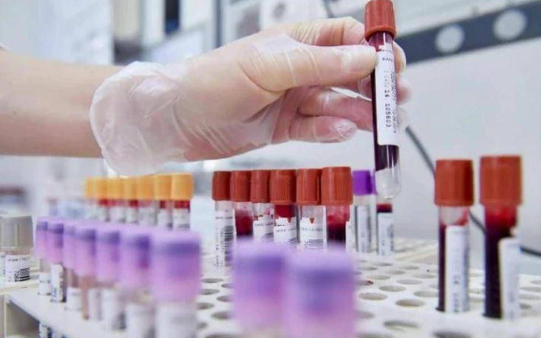 Sclerosi multipla recidivante, Ema raccomanda approvazione ocrelizumab dai 10 anni